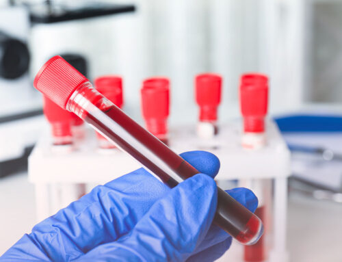 Une santé de fer : ce que votre taux de ferritine veut vous montrer