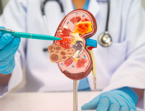 Pyélonéphrite aiguë : les signes d’alerte à surveiller